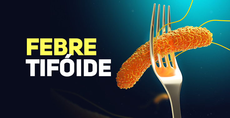 Imagem informativa de saúde com fundo escuro. No lado esquerdo, sobressai o texto FEBRE em letras amarelas e TIFOIDE em letras brancas. No lado direito, uma ilustração 3D mostra uma bactéria em tom laranja-alaranjado presa nos dentes de um garfo metálico.